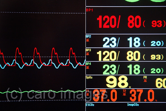 00X061114D012CAROE.JPG