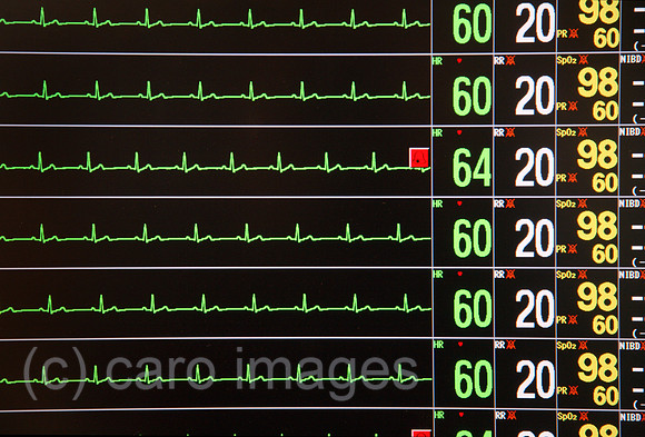 00X061114D009CAROE.JPG