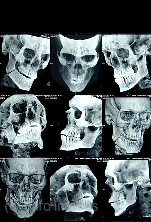 00U081007D060CAROE.JPG