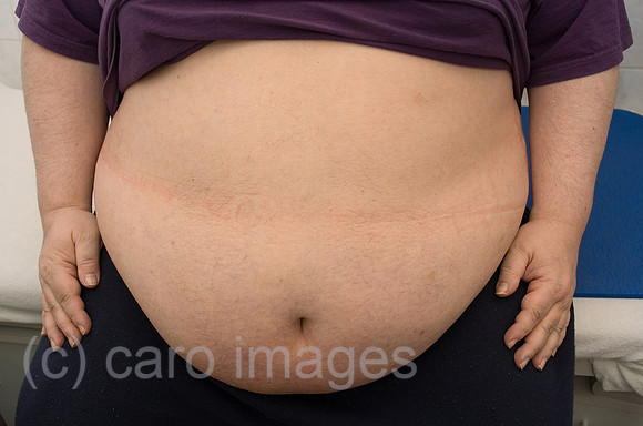 0TS071022D012CAROEP.JPG