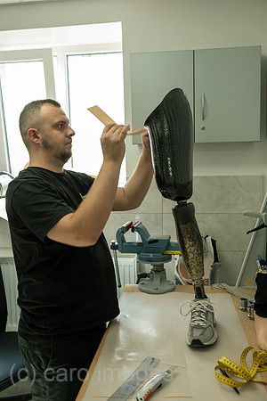 Ukraine, Lwiw - Prothesenwerkstatt im Reha-Zentrum UNBROKEN, spezialisiert auf Kriegsverletzungen und Anpassungen von Prothesen: Anpassung einer Beinprothese
