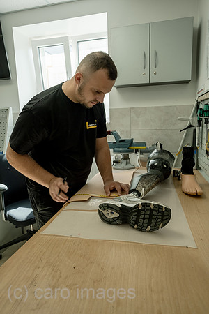 Ukraine, Lwiw - Prothesenwerkstatt im Reha-Zentrum UNBROKEN, spezialisiert auf Kriegsverletzungen und Anpassungen von Prothesen: Anpassung einer Beinprothese